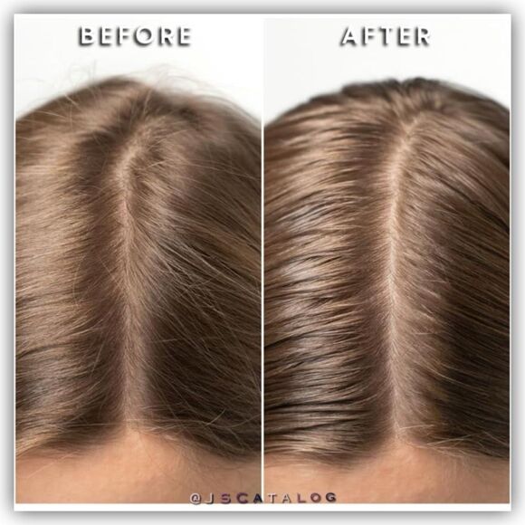 Mudmasky Vitamin-Infused Scalp Serum 60ml / 2.0 FL. OZ. - Strengthens and Thicke - Picture 7 of 7